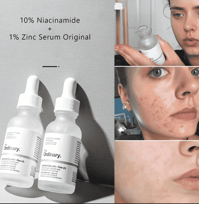 THE ORDINARY NIACINAMIDE 10% + ZINC 1% (30 ML) l Premium Replica